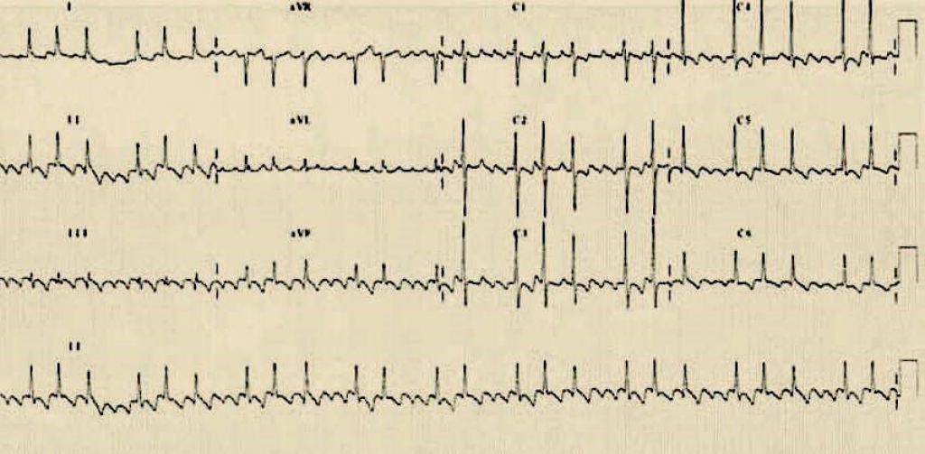 ECGNOW Telecardiologia ecgnow-telecardiologia