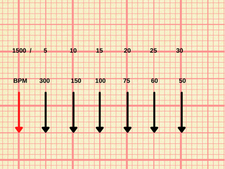 Préhistórico complemento monitor calculo da frequencia cardiaca no ecg ...
