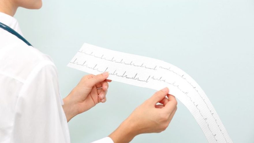 resultados-podem-ser-obtidos-no-exame-de-eletrocardiograma